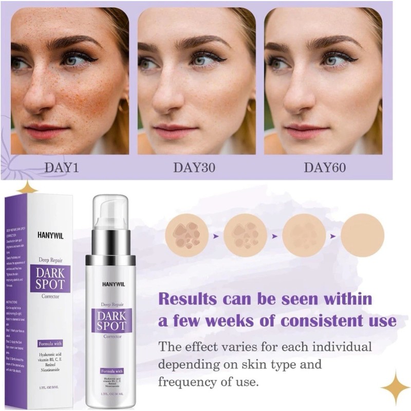 Creme HANYWIL Dark Spot Corrector for Face & Body,Rapid Tone