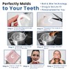 ProDental Thin and Trim Anti Grinding, Teeth Whitening Mouth Guard,