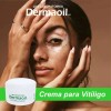 Crema Melagenina Piperina Vitíligo 70gr
