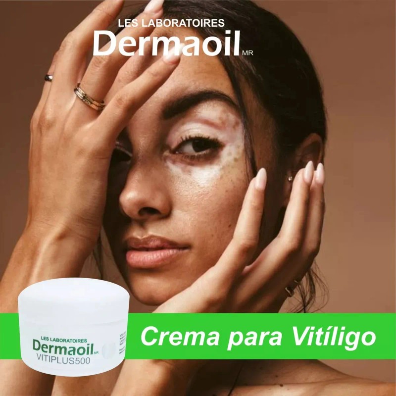 Crema Melagenina Piperina Vitíligo 70gr