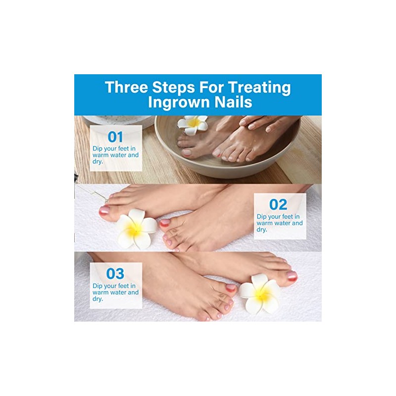 Ingrown Toenail Treatment Drops - Plant-Based Softener Solution