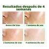 Sérum Facial Con Ácido Salicílico, Reduce Los Poros Y Contro