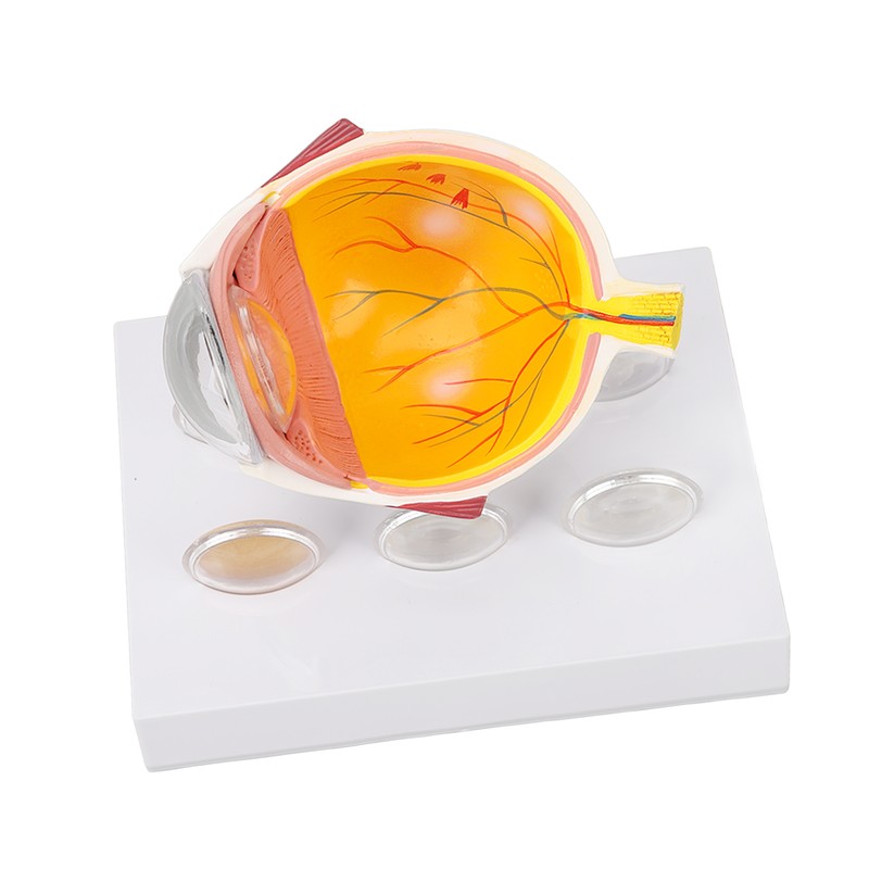 Enlarged Human Eye Anatomical Model Accurate Shows Optic Nerves Cornea