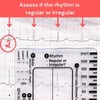 1Pc ECG 7 Step Ruler, ECG 7 Step Ruler for