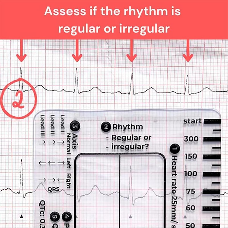 1Pc ECG 7 Step Ruler, ECG 7 Step Ruler for