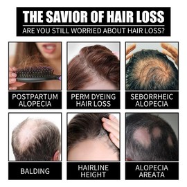 OUHOE Collagen B7 & Biotin Hair Growth Oil - Nourishing Essence for Soft, Strong Hair | Repairing Hair Mask & Scalp Treatment | Heat Protectant & Frizz Control | Vitamin Enriched for Damaged Hair Care - Colour: 3