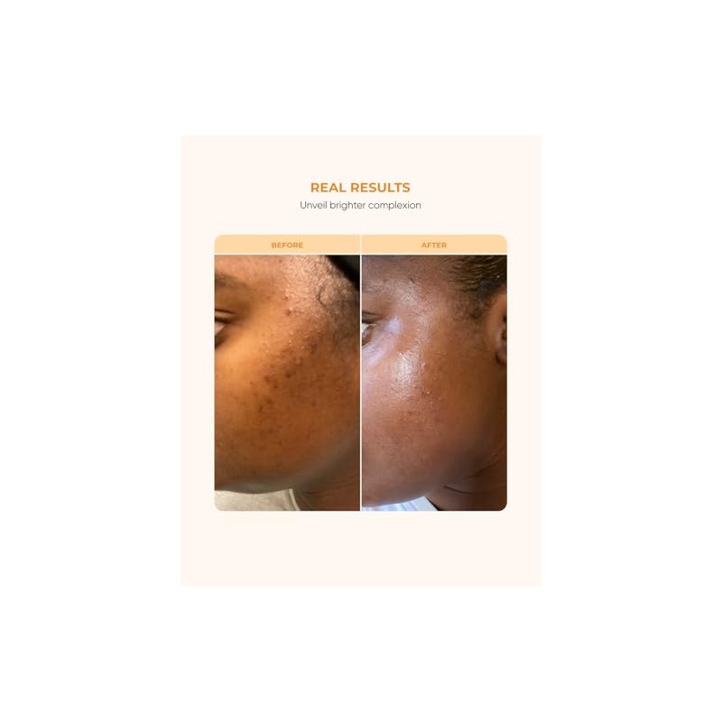 Buttah Skin Vitamina C Serum 1 FL oz e 1.0