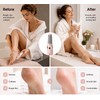 Electric Foot File for Smooth Feet – USB Rechargeable Callus