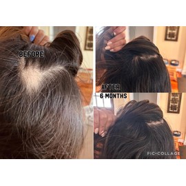 Multi-Peptide Hair Serum For Hair Density & Fall Control With Redensyl, Anagain, Procapil, Biotin, Scalp Serum For Both Men and Women (Pack of 1)