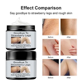 Strawberry Legs Treatment,Keratosis Pilaris Treatment,Skin Exfoliating Repair Lotion,Keratosis Pilaris Cream,Moisturizing Strawberry Skin Smooth Radiant Body Lotion,Body Care for Women Men