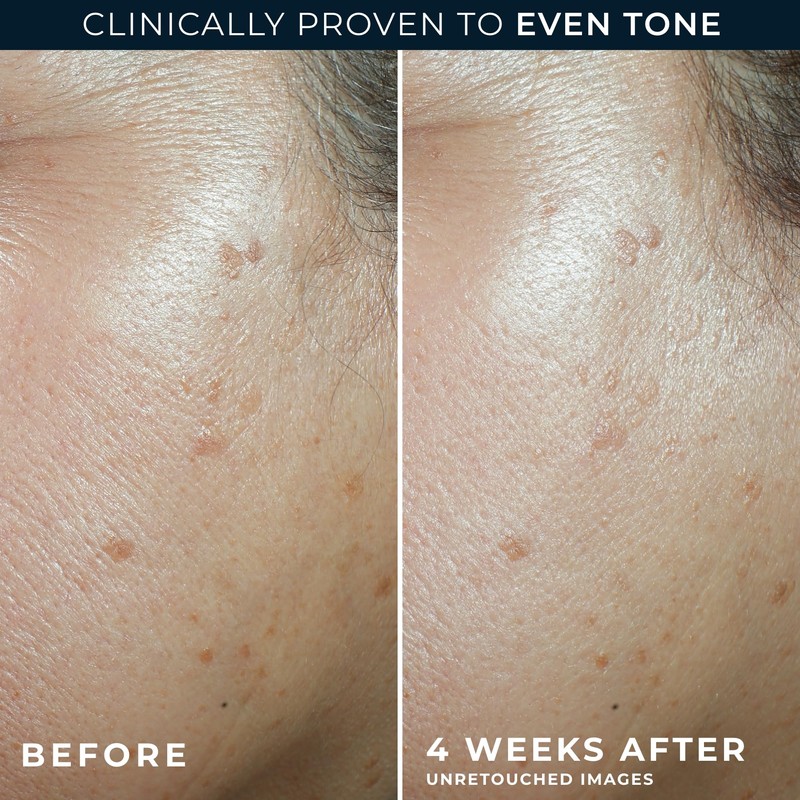 RoC Multi Correxion 5 in 1 Anti-Aging Daily Facial Moisturizer