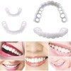 2 Pairs, Top and Bottom,Adjustable for Men and Women,Beautiful Smile(White)