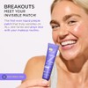 ZitSticka Liquid Pimple Patch - Invisible Spot Treatment