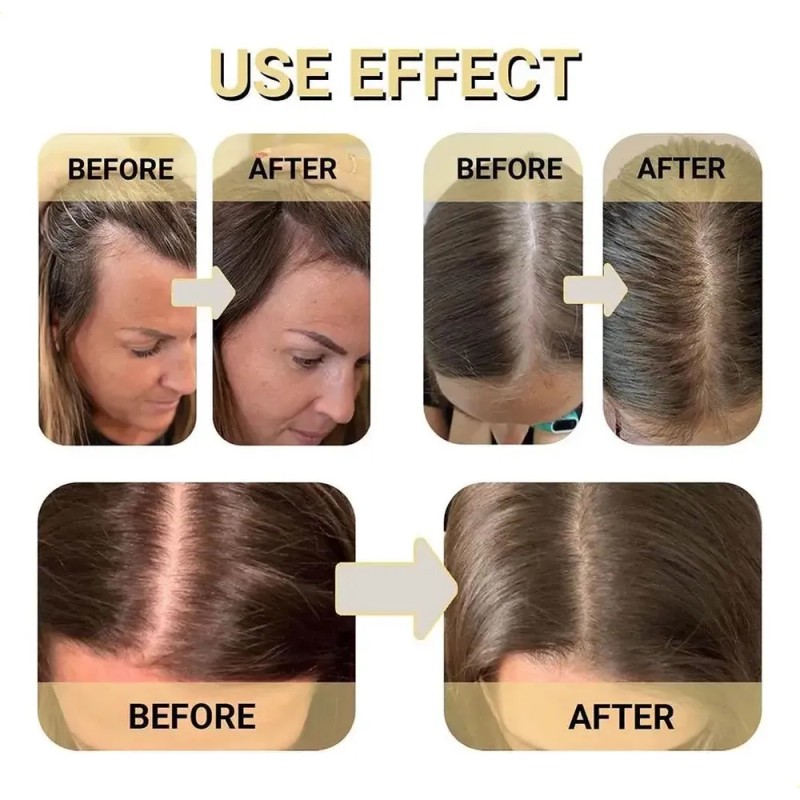 Aceite Para El Cuidado Del Cabello B 1 Unidad, Mezcla