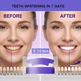 Teeth Whitening Strips, Purple Whitening Strips for Sensitive Teeth, Enamel Safe, Fast Acting for Removing Coffee,Smoking Stains, 7 Days for Smile Effective Gentle Dental Whitener (28Strips, 14Pairs)
