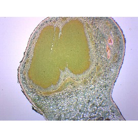 Legume Root Nodule - Prepared Microscope Slide - 75 x 25mm - Biology & Microscopy - Eisco Labs