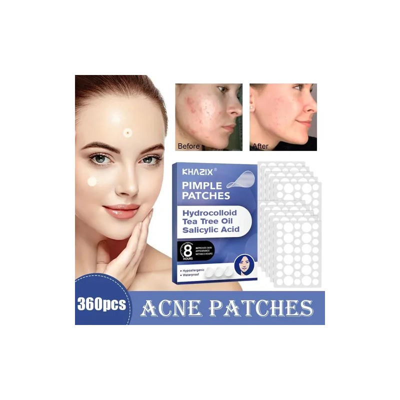 360pcs Breathable Circle Acne Patch Skincare Rapid