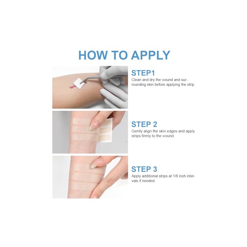 Skin Wound Closure Strips 30 Pcs Sterile Wounds Suture Closures