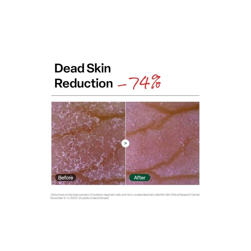 Dr.G- Cuidado peeling suave sin irritación de la piel.