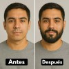 Tratamiento Para Barba Y Bigote 20% - Estimula El Crecimiento