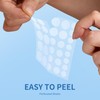 Daolyo Pimple Patches for Face, 4 Size 300 Counts Acne