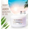 Blanqueadoras Cutis Manchas Piel Blancoderma