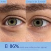 Caudalie Vinoperfect Contorno de Ojos Iluminador con Nicinamida - 15