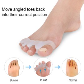 2 Pair Bunion Cushion Toe Separators for kids, Bunion Toe Spacers with Separator for Big Toe, Silicone Toe Spacer Crooked Toes Gel Shield for Relieve Foot Pain Hammer Toes Straightener Overlapping Toe