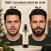 Sérum para Crecimiento de Barba con Biotina Capixyl 100 ml