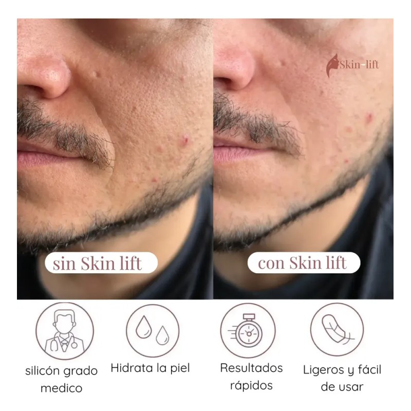 Parches Silicona Antiarrugas Skin Lift Reutilizables Día Noche