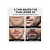 2pc Sérum Para El Crecimiento De La Barba Con Biotina