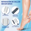 Foot Callus Remover Gel Extra Strength 6 oz – GIVOOBE