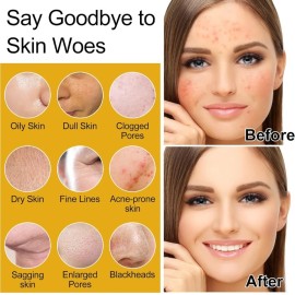 Skin Care Set, Women Teen Skincare Rice Water Hydrate Glow Repair Anti-Aging...