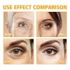 Crema Hidratante Para Ojos Con Péptidos 5d Crema Hidratante