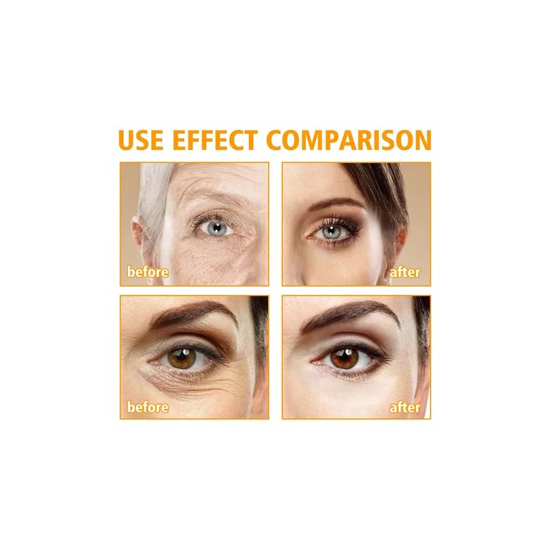 Crema Hidratante Para Ojos Con Péptidos 5d Crema Hidratante