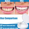 1 Pair of Fake Teeth, False Teeth Veneers, Cosmetic Tooth