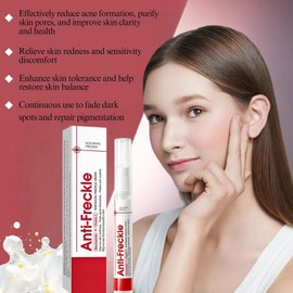 Freckle Removal Cream with Niacinamide&Vitamin C–Dark Spot Remover for Face,Dark Spot Corrector,Reduces Age Spots,Melasma,Sun Spot,Blemish,Improve Skin Tone,for All Skin Types,15g