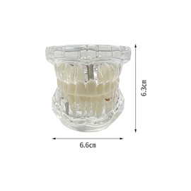 Modelo de implante de dientes, para enseñanza, modelo de enfermedad, estándar, extraíble, patología de YOUYA DENTAL