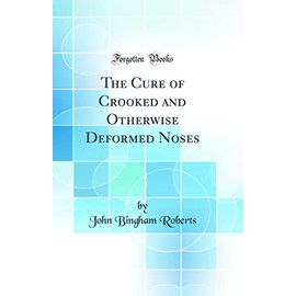 The Cure of Crooked and Otherwise Deformed Noses (Classic Reprint)