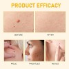 Bee Venom Skin Restoration Cream, Professional Bee Venom Skin Cream,deeply