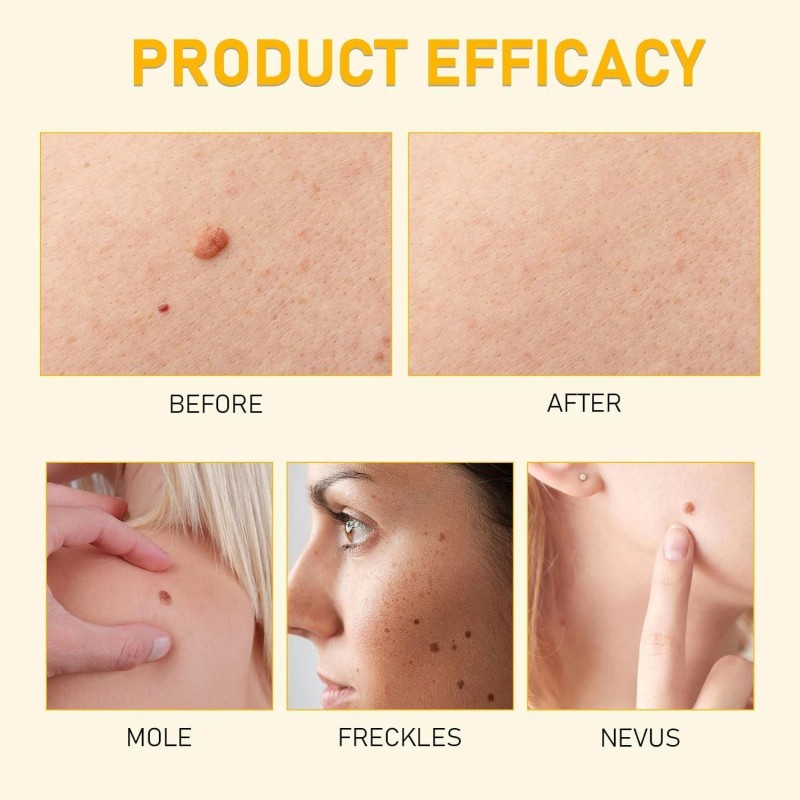 Bee Venom Skin Restoration Cream, Professional Bee Venom Skin Cream,deeply