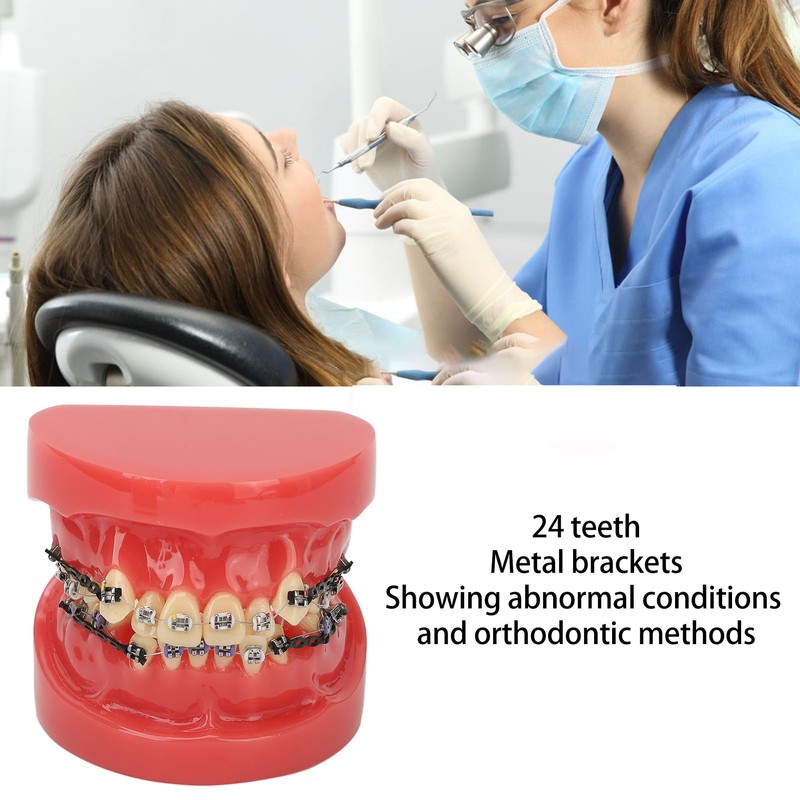Professional Dental Demonstration Orthodontic Model with Metal Wires and Bracket