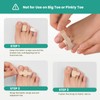 Welnove Hammer Toe Straightener - 16 Pack Broken Toe Wraps