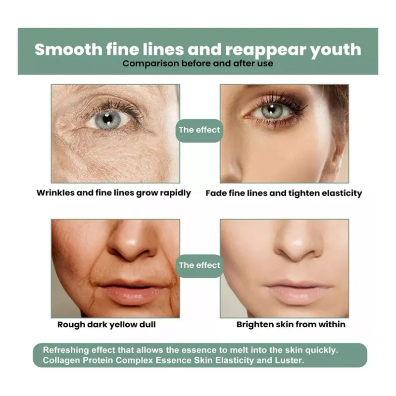 5 Piezas De Suero Facial Antiarrugas Collagen Boost Essence