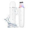 Exfoliador De Piel Anlan Ultrasónica Con Luz Roja Y Azul