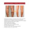 Varicose Veins Gel, Veinhealing Varicose Veins Gel, Refreshes and Relaxes