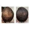 Shampoo Vandé Capilar Caballo Y Biotina 20 L.