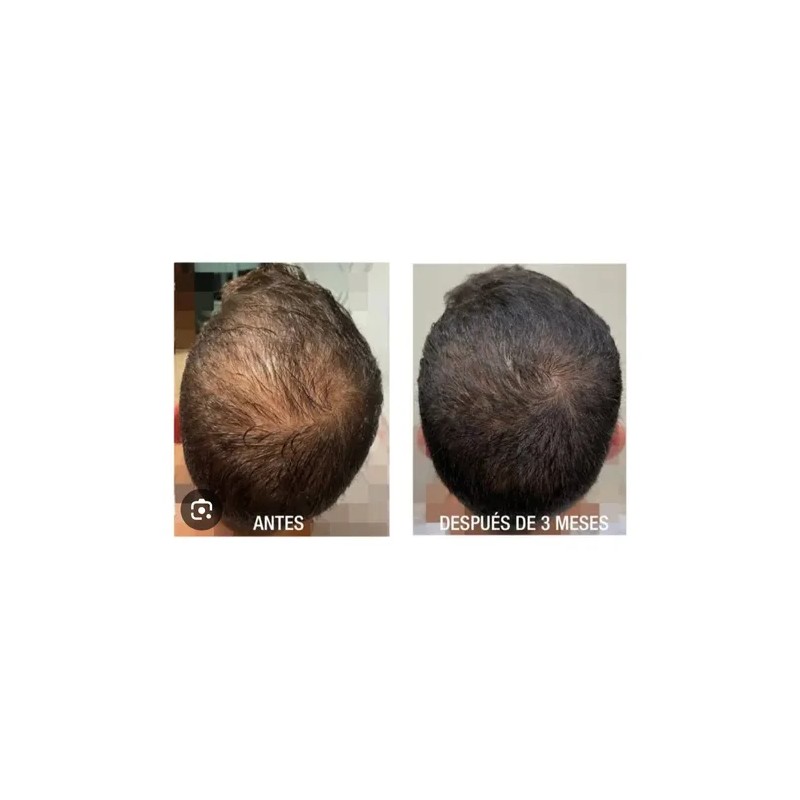 Shampoo Vandé Capilar Caballo Y Biotina 20 L.