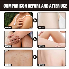 Haiyox Moroccan Black Soap,Moroccan Soap,M-oroccan Body Scrub,Black So-ap Dispenser Bathroom,Exfoliating Shower Gel For Soft Skin,Deep Cleaning For Whole Body,Organic Long Lasting Fragrance Cleansing