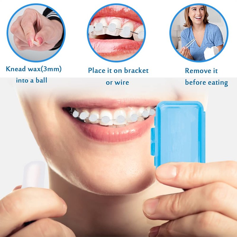 Braces Orthodontic Wax Dental Ortho Wax for Teeth Braces Invisalign,
